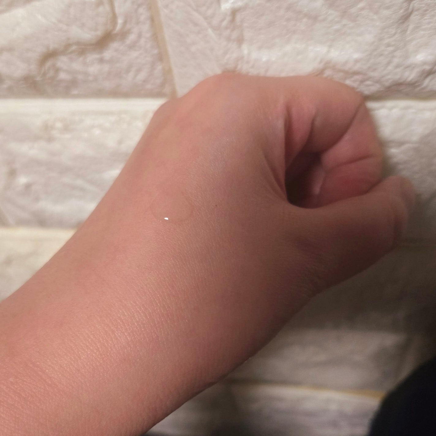 あゆこ on LIPS 「タカミスキンピール(30mL)容量・税込価格10ml・1,00..」(4枚目)