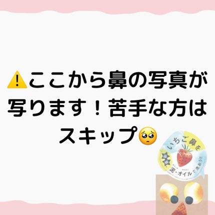 りお on LIPS 「..脱!いちご鼻🍓🥸いちご鼻で悩んでる方多いのでは??私もその..」(5枚目)