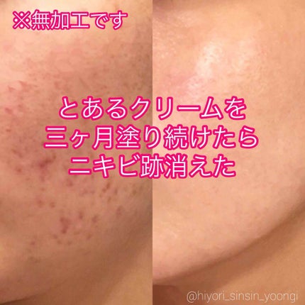 ビジャ シカバーム EX/innisfree/フェイスバームを使ったクチコミ(1枚目)