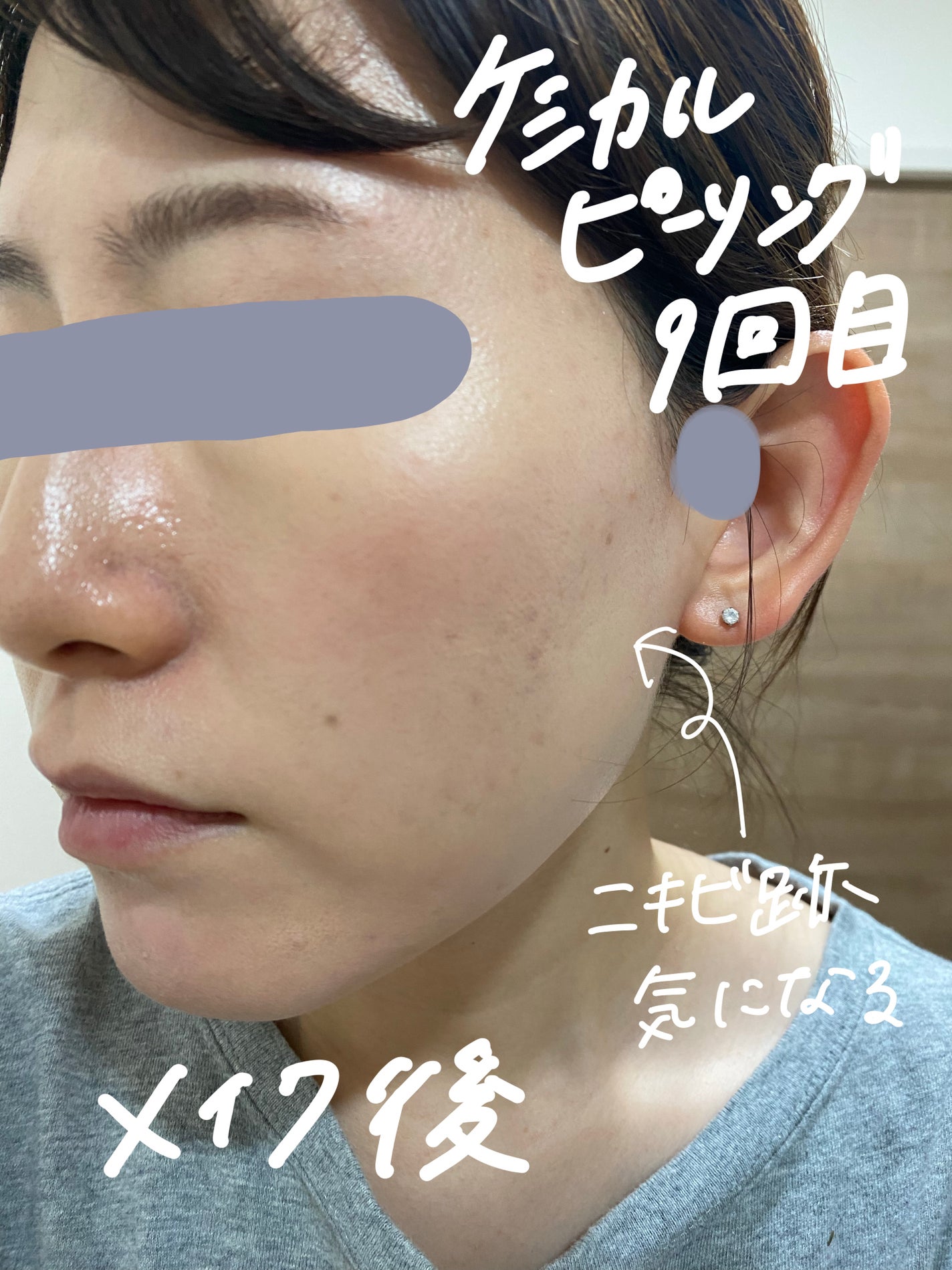 ACアクティブ クレンジングリキッド/NOV/クレンジングウォーターを使ったクチコミ(3枚目)