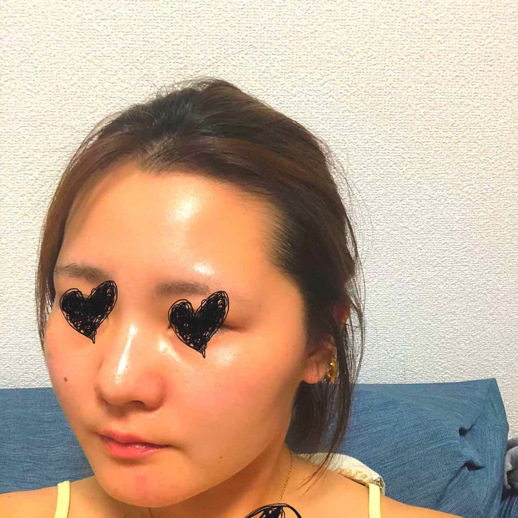 クラリファイング ローション 2/CLINIQUE/拭き取り化粧水を使ったクチコミ（3枚目）