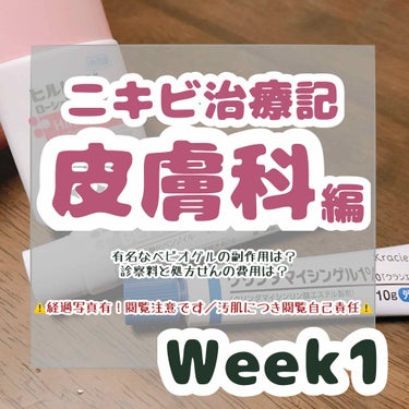 双海 on LIPS 「ニキビ治療期／皮膚科編⚡️Week1『皮膚科の先生助けてくださ..」（1枚目）