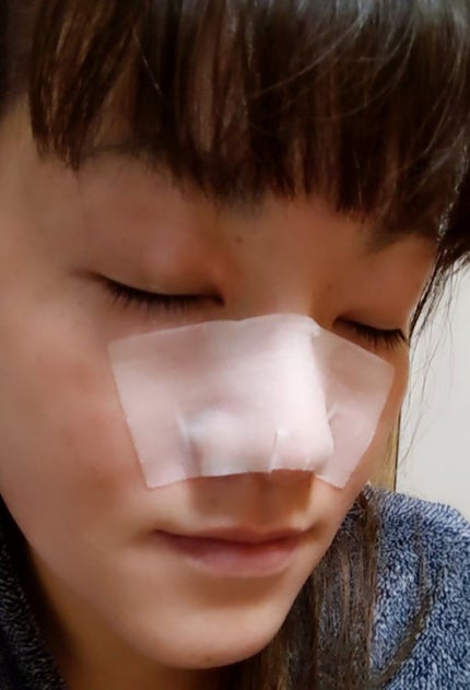 BHクリアノーズパック/CucuporeC/シートマスク・パックを使ったクチコミ(5枚目)