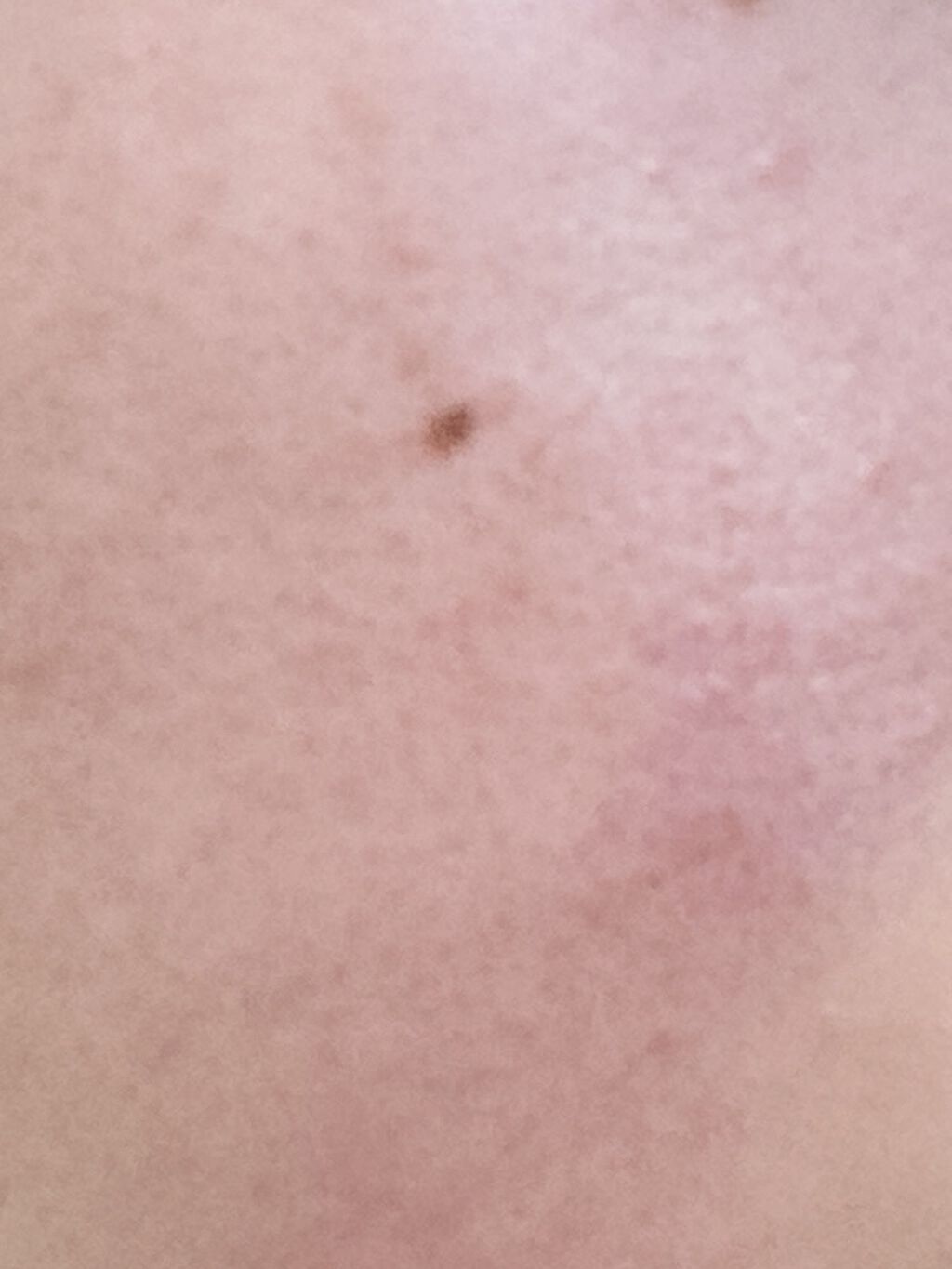 トリクセラNT フルイドクリーム/アベンヌ/ボディクリームを使ったクチコミ（2枚目）