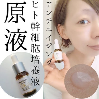 ピュアソーム 
PureSome 9ml 

ヒト幹細胞培養液３０％配合
美容液


もっちり～
もっちり～
💕贅沢すぎる配合💕

保湿成分としてプラセンタ・セラミド・ヒアルロン酸・コラーゲン・オリーブ