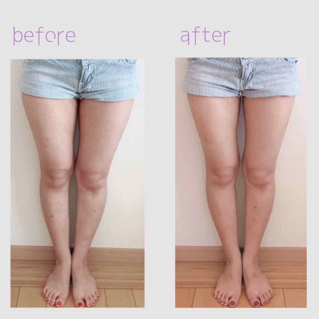 ころも on LIPS 「8月2日に脚やせ宣言をして約1ヶ月が経ちましたお見苦しい写真失..」(2枚目)