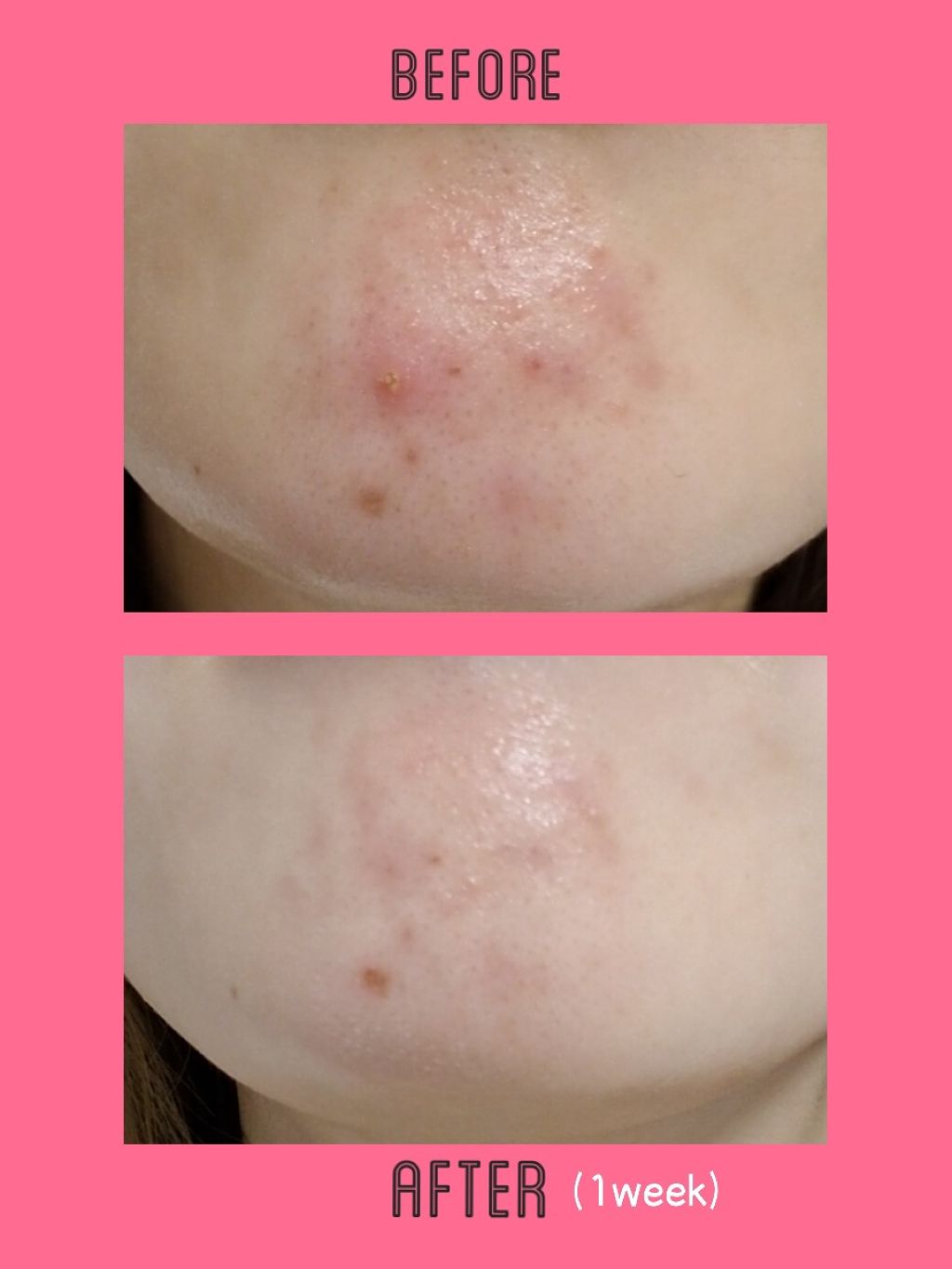 ビジャ シカバーム EX/innisfree/フェイスバームを使ったクチコミ(2枚目)