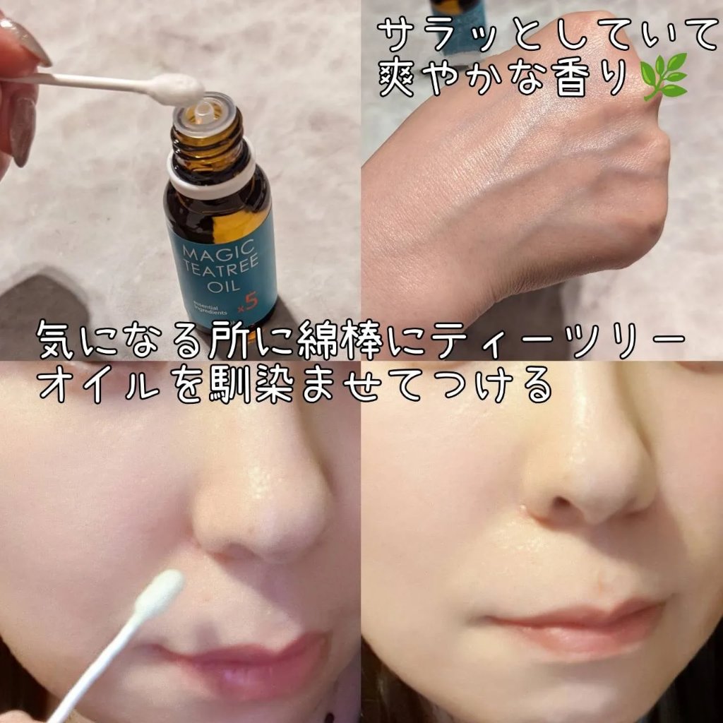 マジックティーツリーオイル/ブラン/フェイスオイルを使ったクチコミ（2枚目）