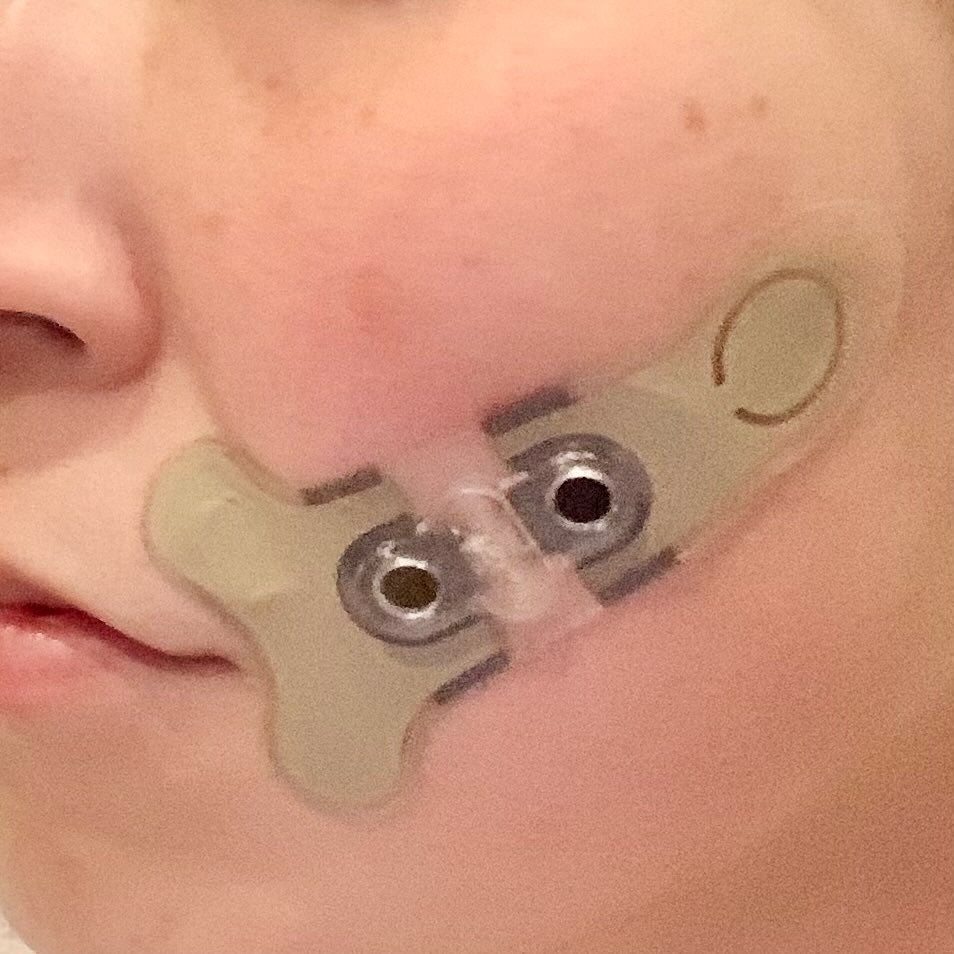 デザインリフト モア/YA-MAN TOKYO JAPAN/美顔器・マッサージを使ったクチコミ(5枚目)