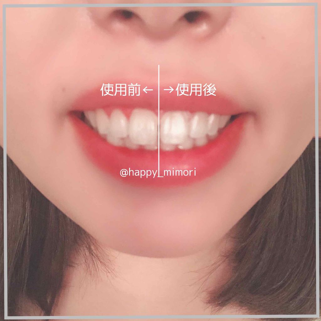 ホワイトコート パールホワイト/ボディマジック/その他オーラルケアを使ったクチコミ(3枚目)