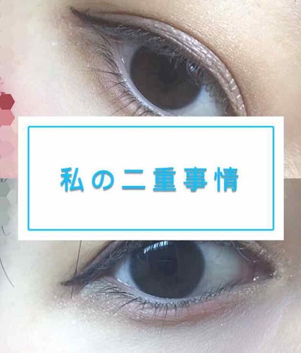 アイトーク/アイトーク/二重まぶた用アイテムを使ったクチコミ(1枚目)