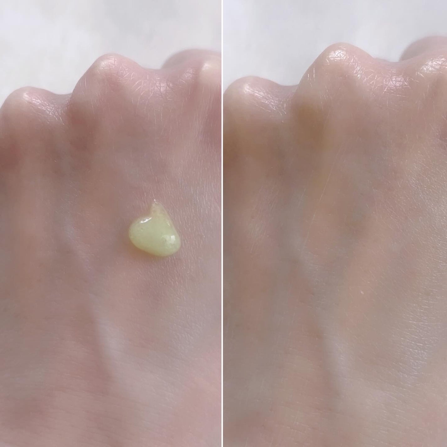 サンデーシカサンセラム/EDIT.B/美容液を使ったクチコミ(2枚目)