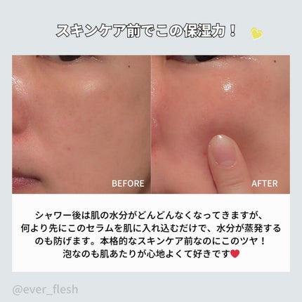 バイタルイミュンショットファーストバブルセラム/SKIN SIGNAL/美容液を使ったクチコミ(5枚目)