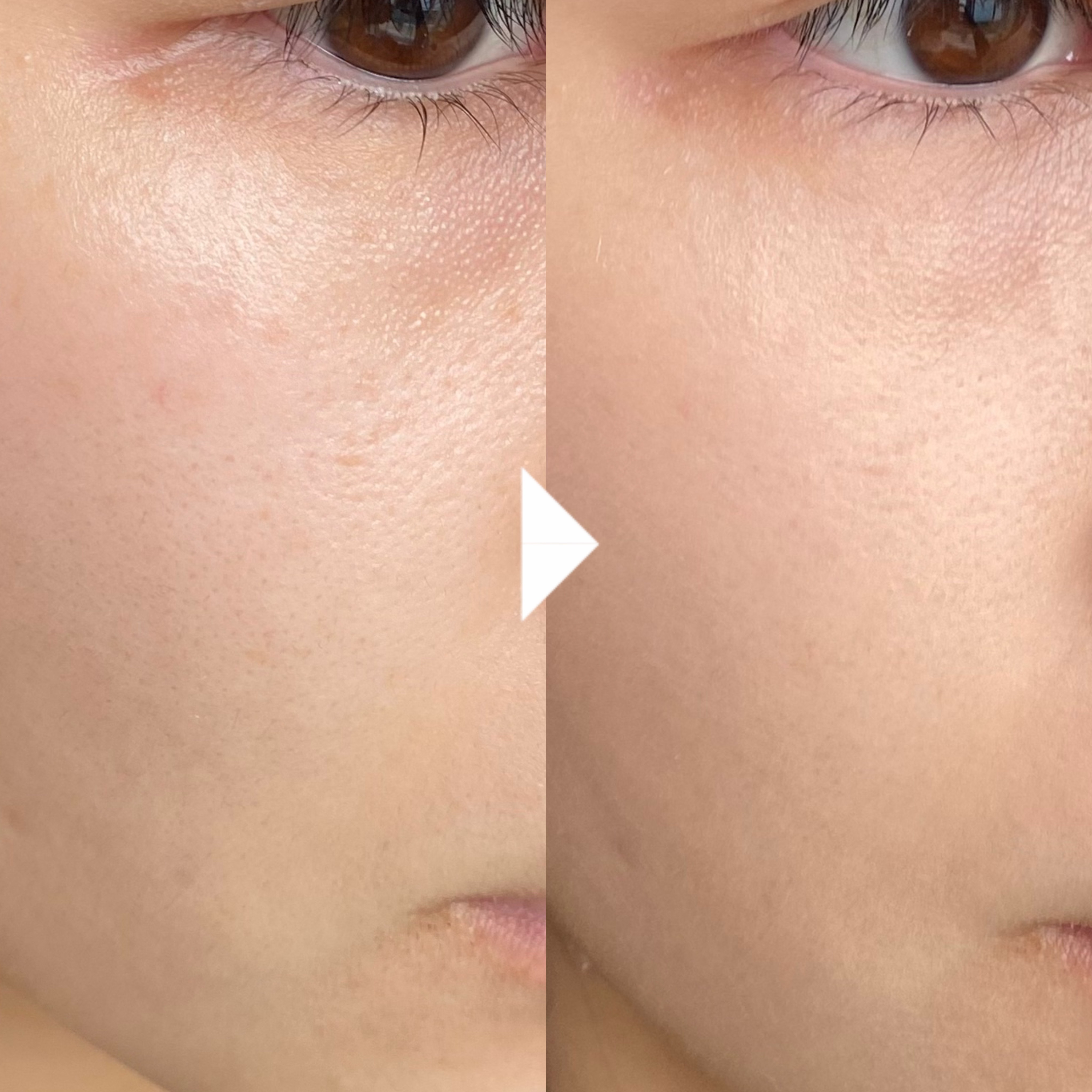 プリマヴィスタ ブライトチャージ パウダー スポンジ別売り/プリマヴィスタ/パウダーファンデーションを使ったクチコミ（2枚目）