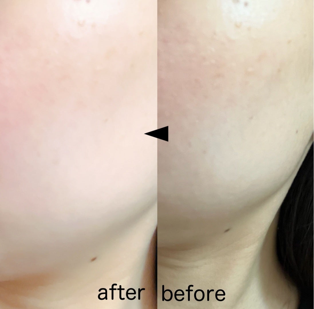 パーフェクティングフィッティング フルカバレッジクッション/LILIBETH/クッションファンデーションを使ったクチコミ(4枚目)