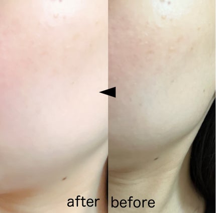 パーフェクティングフィッティング フルカバレッジクッション/LILIBETH/クッションファンデーションを使ったクチコミ(4枚目)