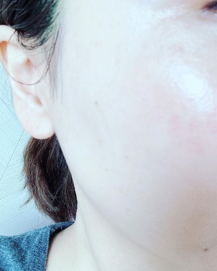 Nude ファーストCブースト/ONLY MINERALS/美容液を使ったクチコミ(4枚目)