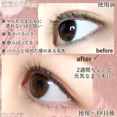 スカルプdボーテ ピュアフリーアイラッシュセラム プレミアムクイーン アンファー スカルプd の効果に関する口コミ 敏感肌におすすめのまつげ美容液 すぐにまつ毛を伸ば By Satomi 混合肌 代後半 Lips