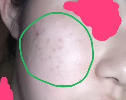 を使ったクチコミ(2枚目)