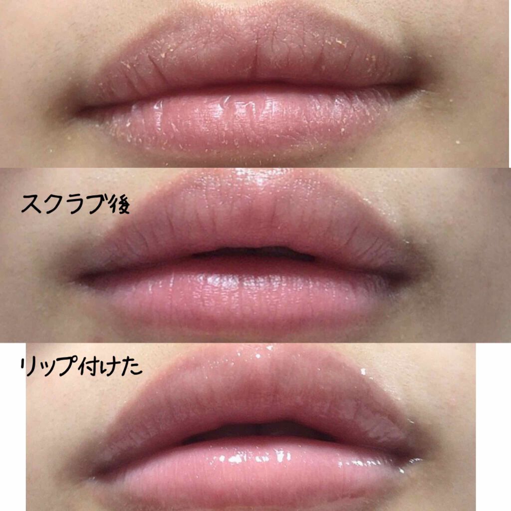バブルガムフレーバー リップスクラブ ラッシュの口コミ 私の唇のガッサガサ具合 しかも痛いくらいガサガサ By Yuun 普通肌 代前半 Lips バブルガムフレーバー リップスクラブ ラッシュの口コミ 私の唇のガッサガサ具合 しかも痛いくらいガサガサ By Yuun 普通肌 代前半 Lips