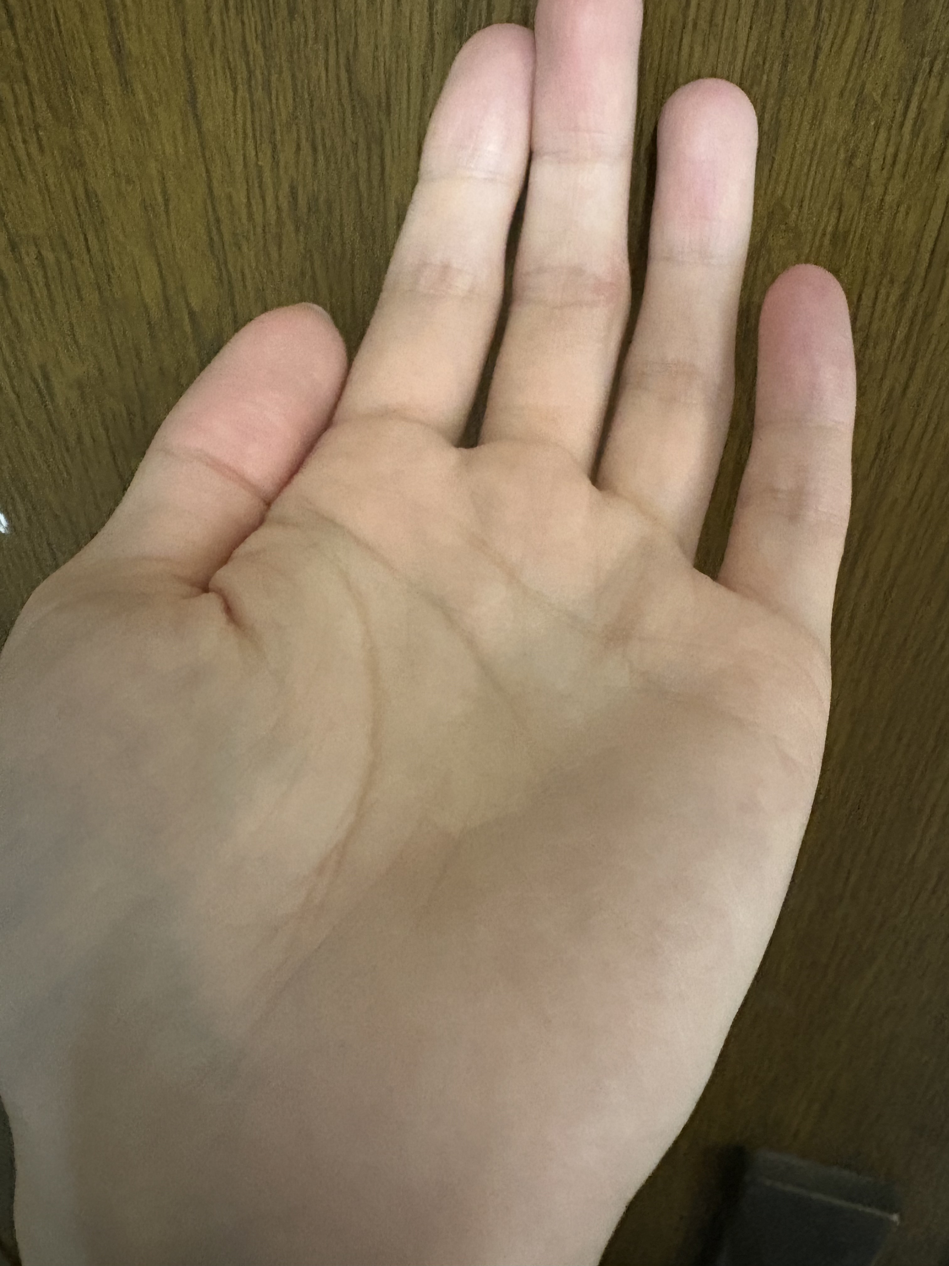 チャップアップ育毛ローション/CHAP UP(チャップアップ)/頭皮ローションを使ったクチコミ（2枚目）