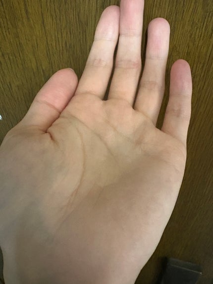 チャップアップ育毛ローション/CHAP UP(チャップアップ)/頭皮ローションを使ったクチコミ(2枚目)