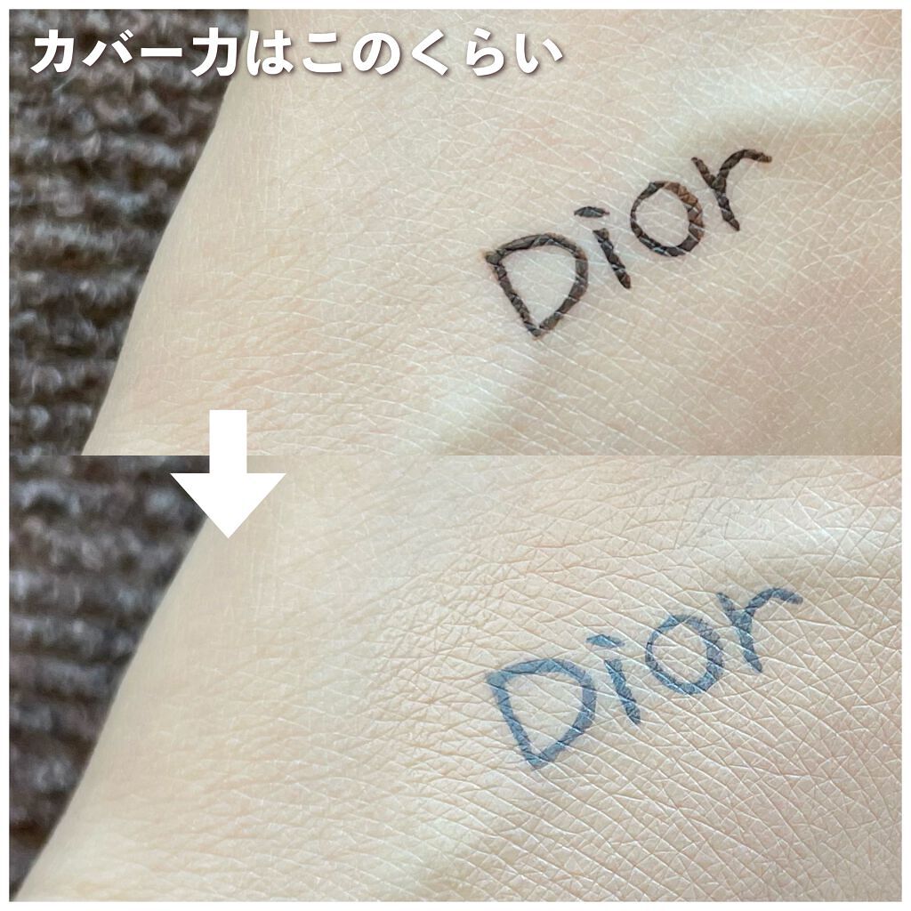 【旧】ディオールスキン フォーエヴァー スキン コレクト コンシーラー/Dior/リキッドコンシーラーを使ったクチコミ(4枚目)