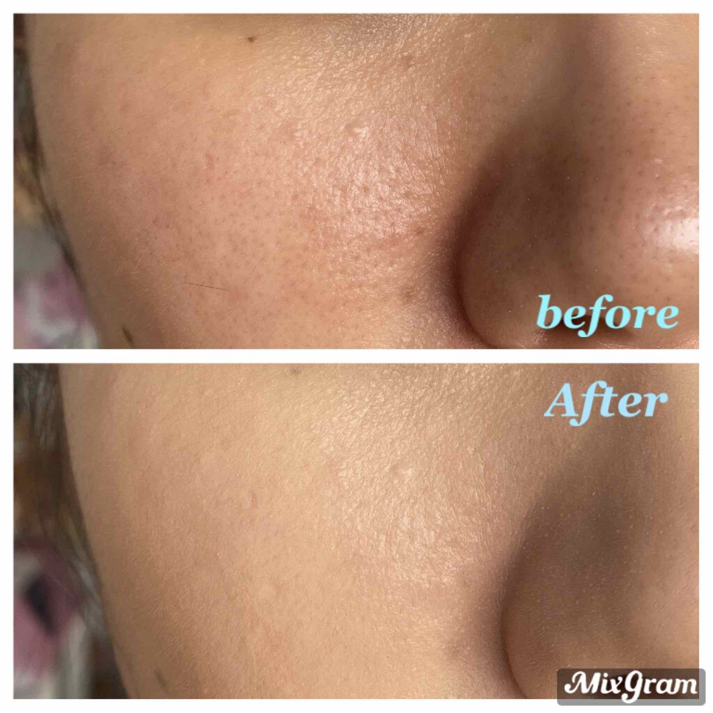 キル カバー グロウ クッション/CLIO/クッションファンデーションを使ったクチコミ(3枚目)