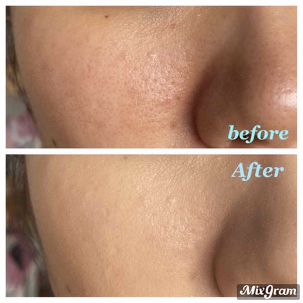 ãã« ã«ã㌠ã°ã㊠ã¯ãã·ã§ã³/CLIO/ã¯ãã·ã§ã³ãã¡ã³ããŒã·ã§ã³ã䜿ã£ãã¯ãã³ãïŒ3æç®ïŒ