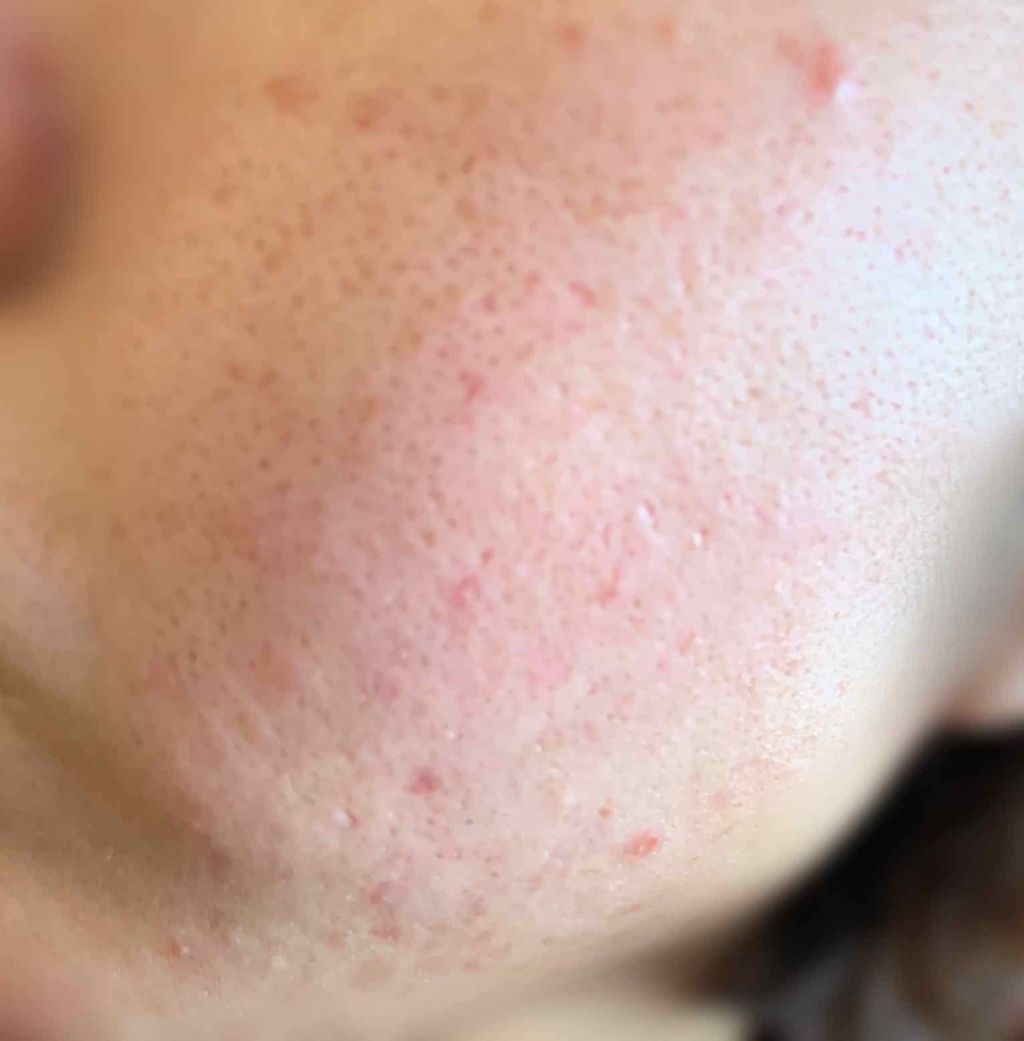 むーな on LIPS 「誰か助けてください…⚠️閲覧注意です。とっても汚いです!!前の..」(3枚目)