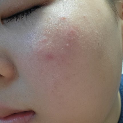 明色美顔水 薬用化粧水/美顔/化粧水を使ったクチコミ(2枚目)