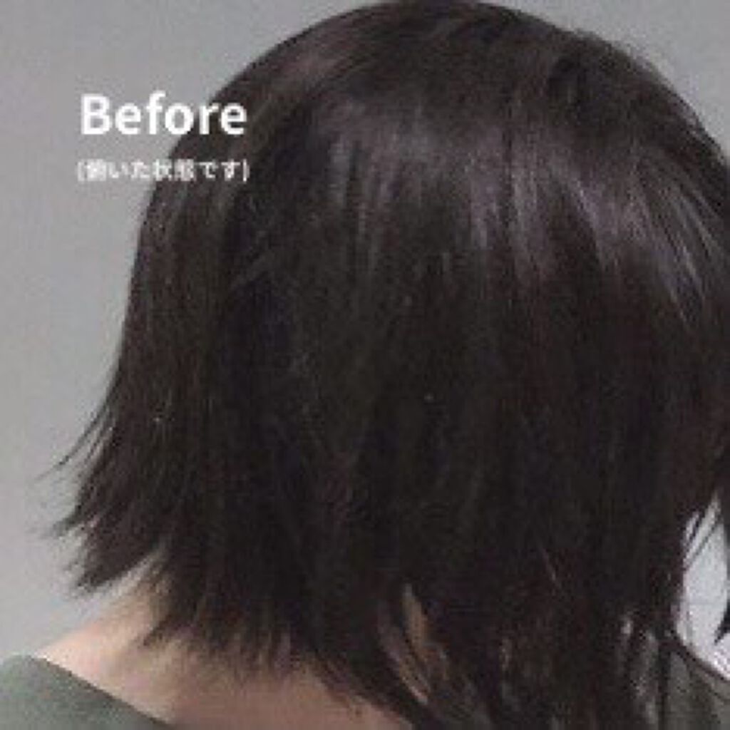 オキシドール(医薬品)/日本薬局方/その他を使ったクチコミ（2枚目）