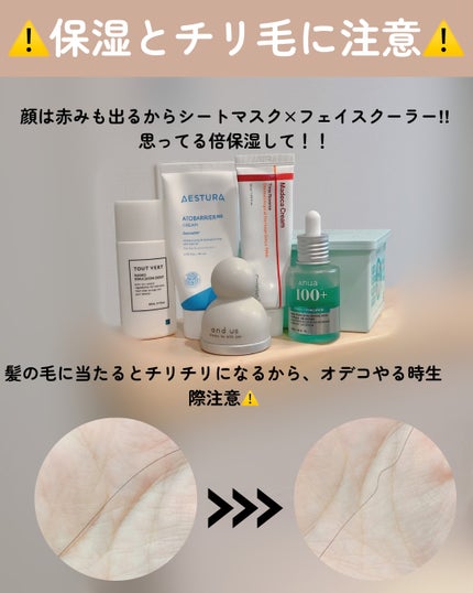 アトバリア365クリーム/AESTURA/フェイスクリームを使ったクチコミ(5枚目)