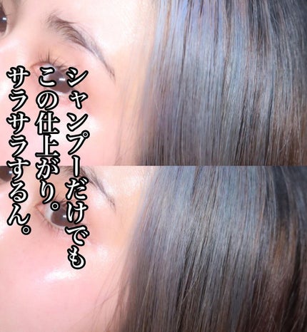 モウダス 薬用 発毛促進剤/北の快適工房/頭皮ローションを使ったクチコミ(5枚目)
