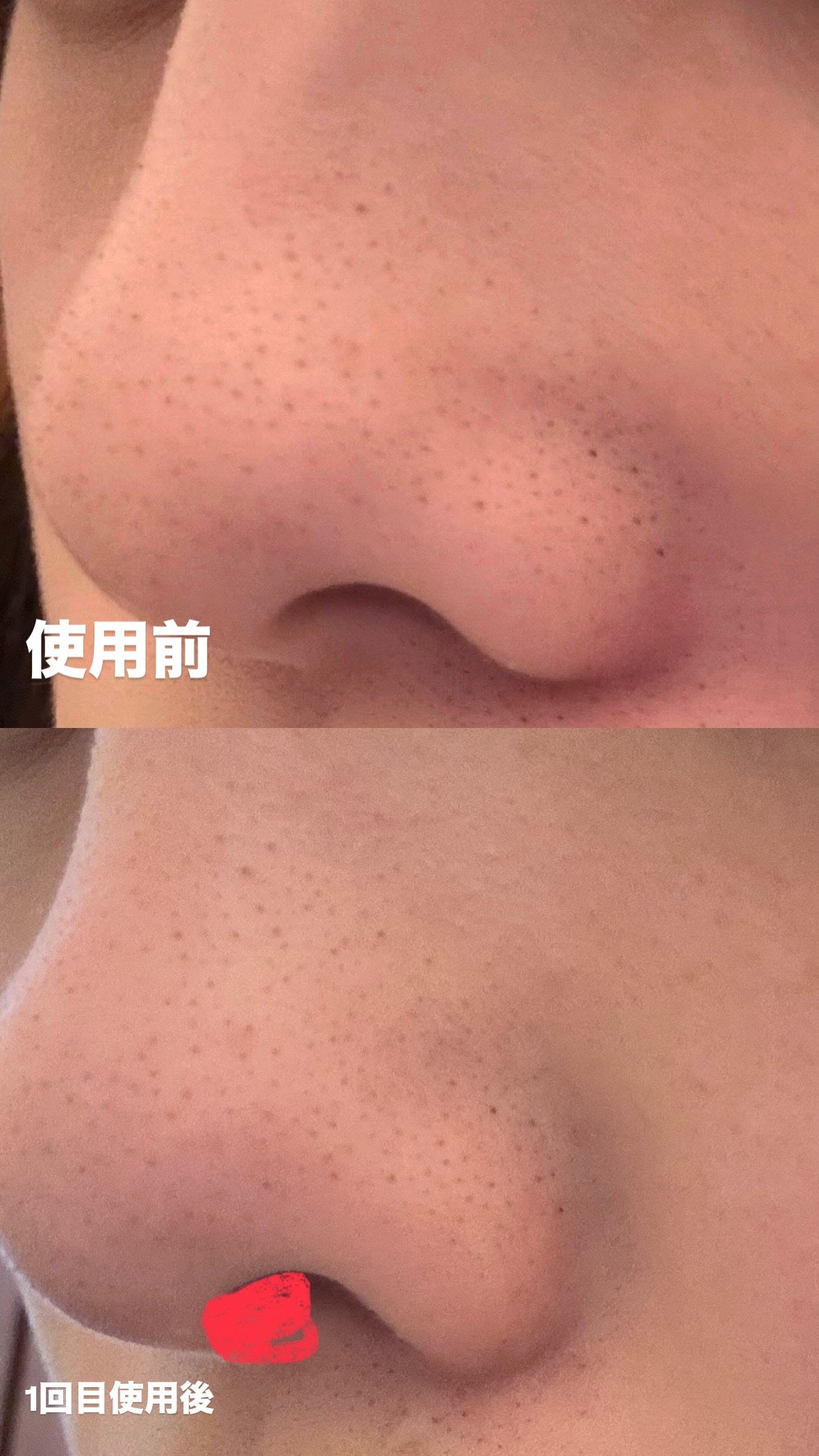 パーフェクトワンフォーカス スムースクレンジングバーム ディープブラック/PERFECT ONE FOCUS/クレンジングバームを使ったクチコミ(3枚目)