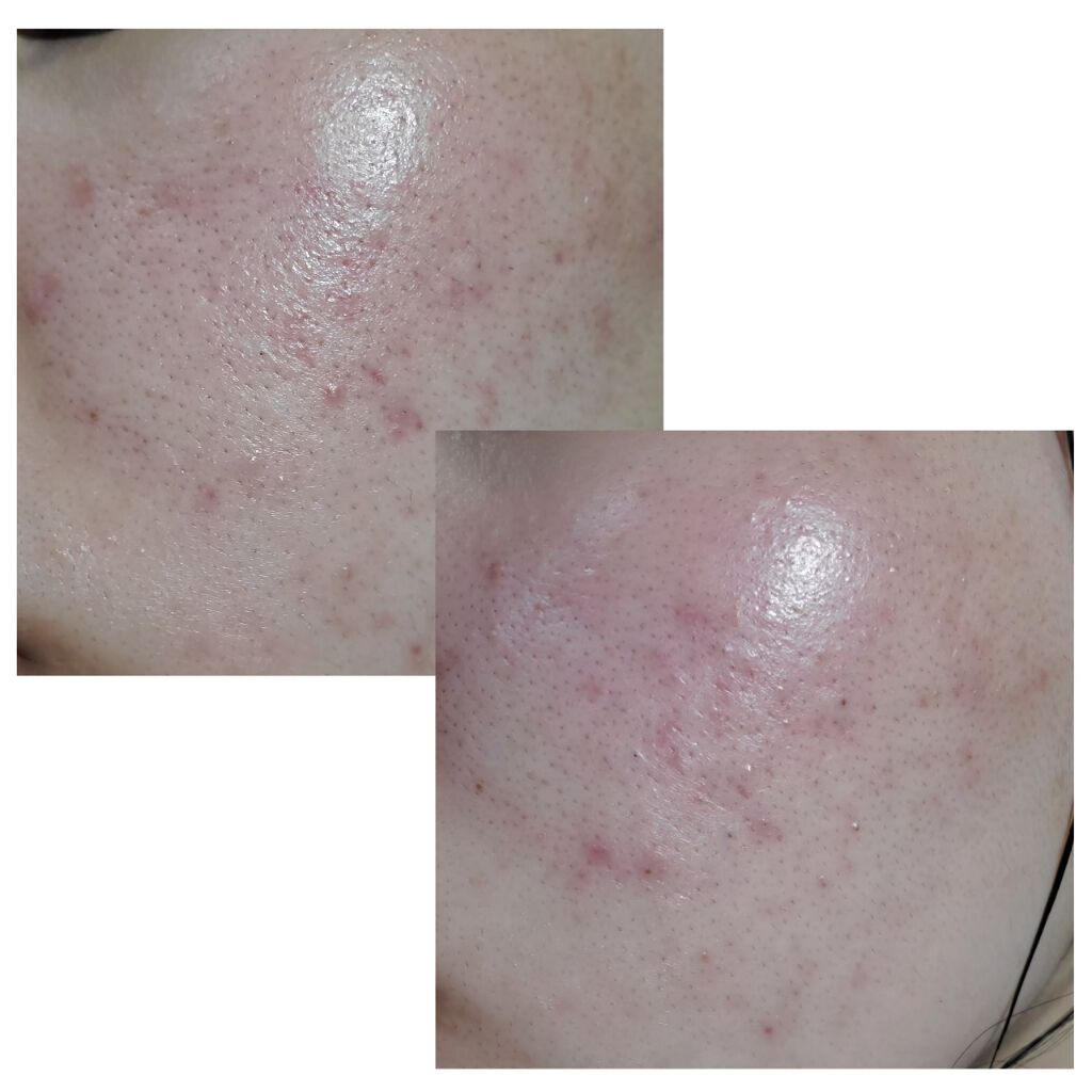 ぴい on LIPS 「閲覧頂きありがとうございます☺︎︎今自分磨きを頑張っているとこ..」(2枚目)