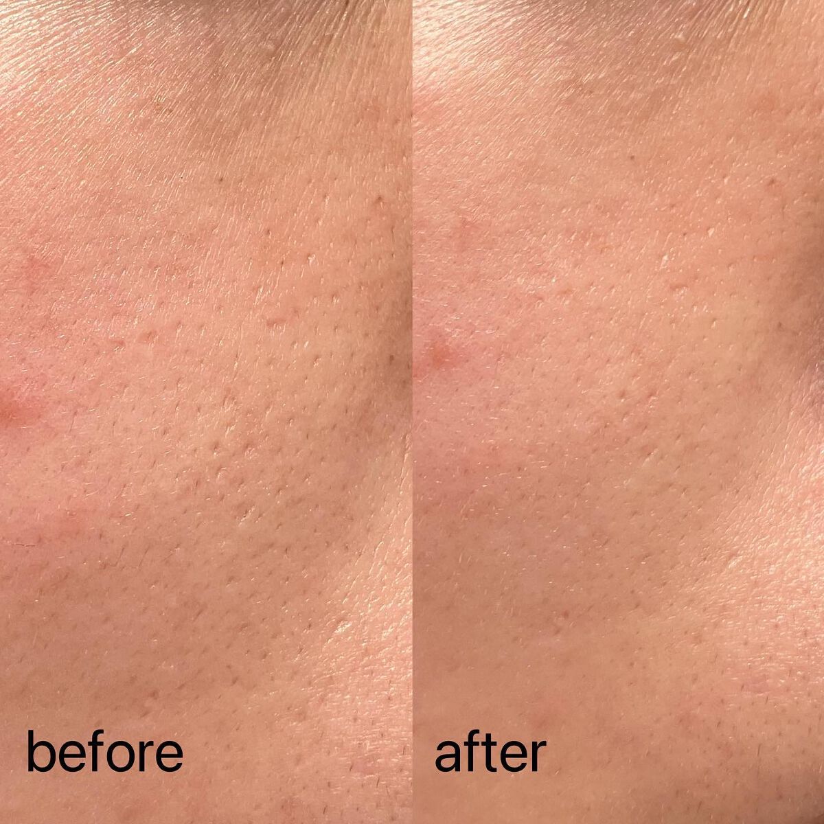 アドバンスド スネイル96 ムチンパワーエッセンス/COSRX/美容液を使ったクチコミ（3枚目）