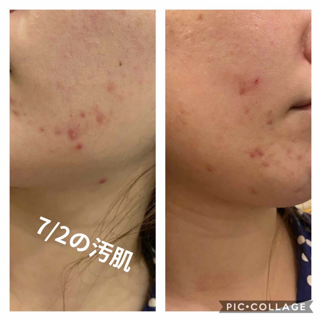 クリアウォッシュ/オルビス/洗顔フォームを使ったクチコミ(2枚目)