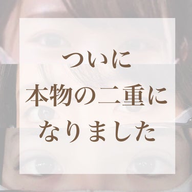 🐥はるピ！🐯 on LIPS 「＼二重埋没レポ／こんにちは！はじめまして、はるるです🐯2〜3年..」（1枚目）