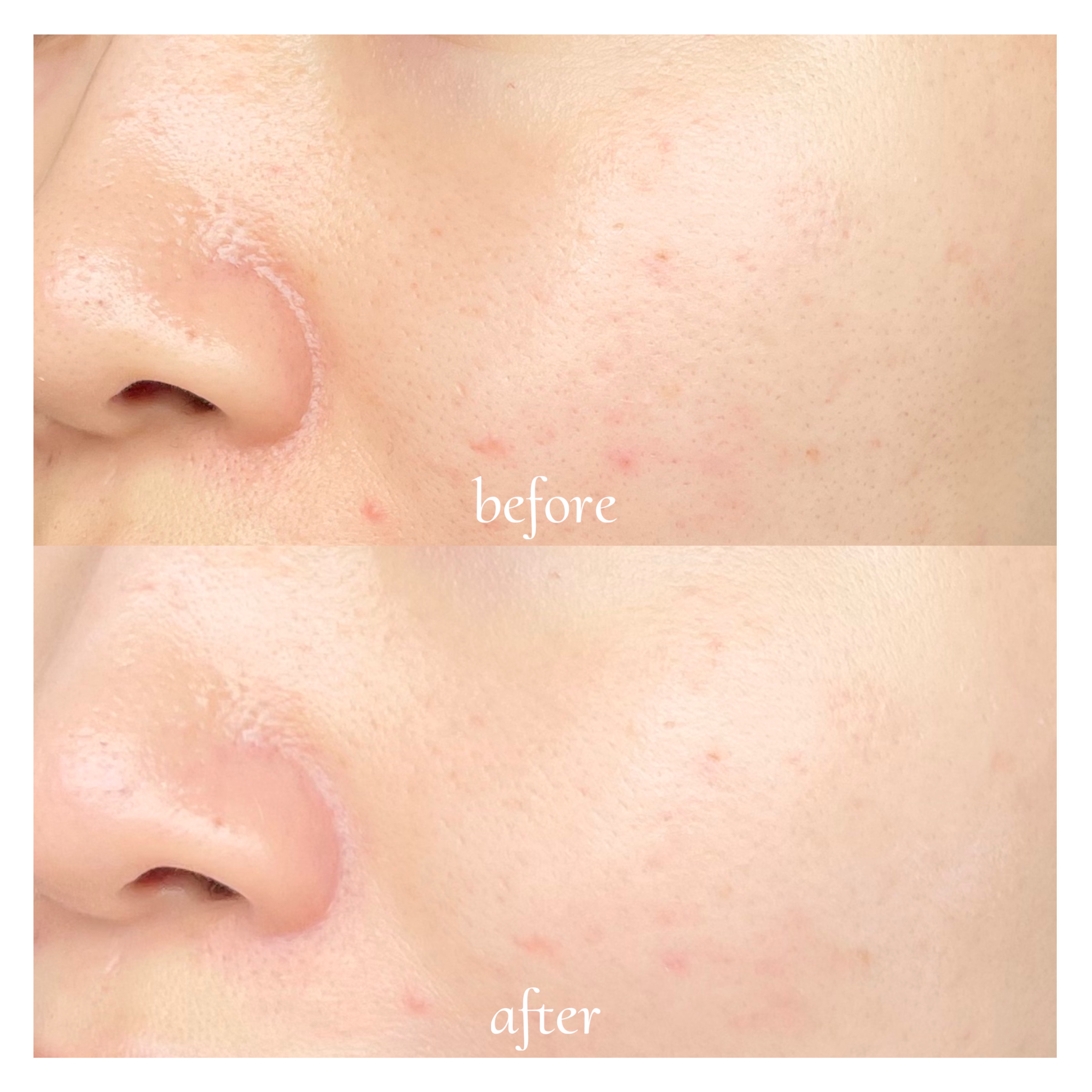 ビタトーンアップサンクリーム/TOCOBO/日焼け止めクリームを使ったクチコミ（3枚目）