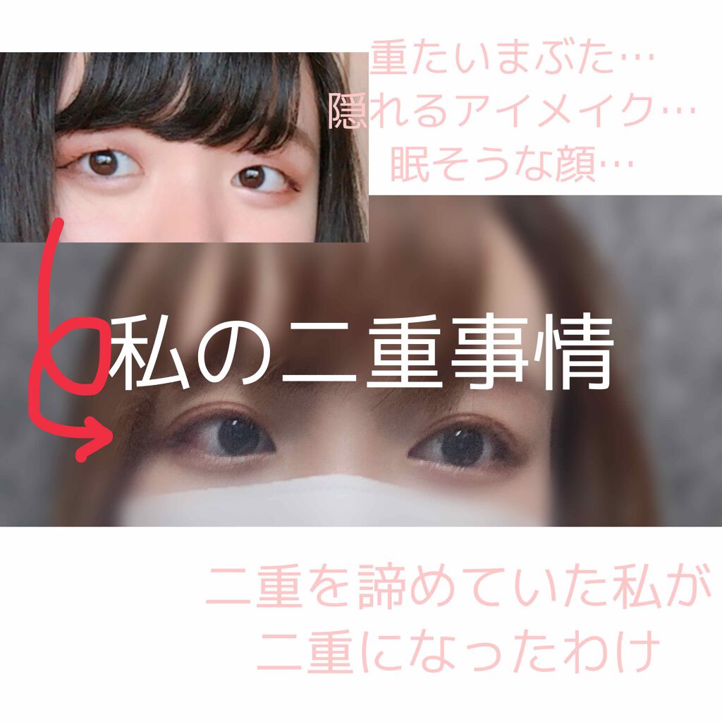 のびーるアイテープ（絆創膏タイプ、レギュラー）/DAISO/二重まぶた用アイテムを使ったクチコミ（1枚目）