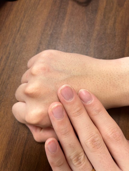 ドクダミ 77 スージングトナー/Anua/化粧水を使ったクチコミ(5枚目)