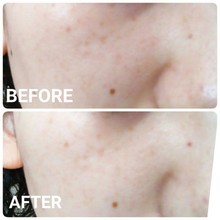 レスオン スキンシカバーム/HOLIKA HOLIKA/フェイスクリームを使ったクチコミ(5枚目)