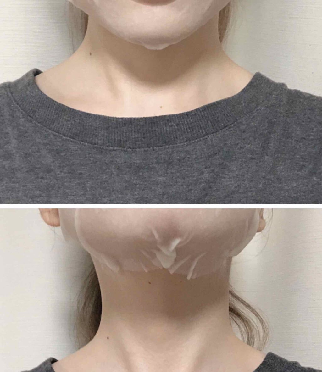 リズムコンセントレートマスク/AYURA/シートマスク・パックを使ったクチコミ(4枚目)