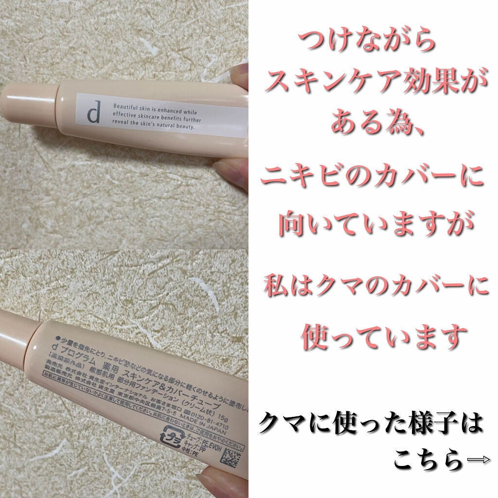 薬用 スキンケア&カバーチューブ/d プログラム/クリームコンシーラーを使ったクチコミ(5枚目)