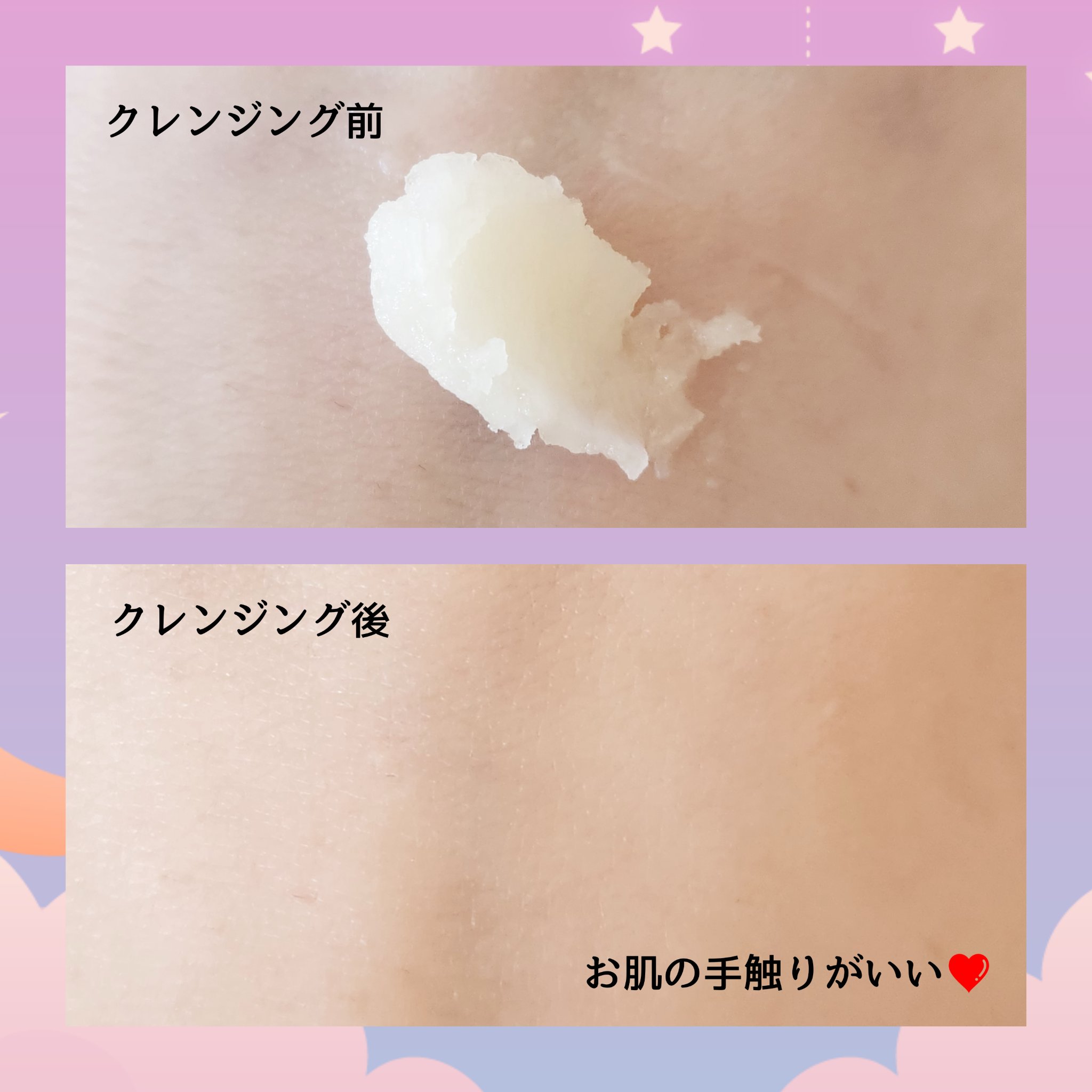 Blooming canola cleansing balm/suiskin/クレンジングバームを使ったクチコミ（3枚目）