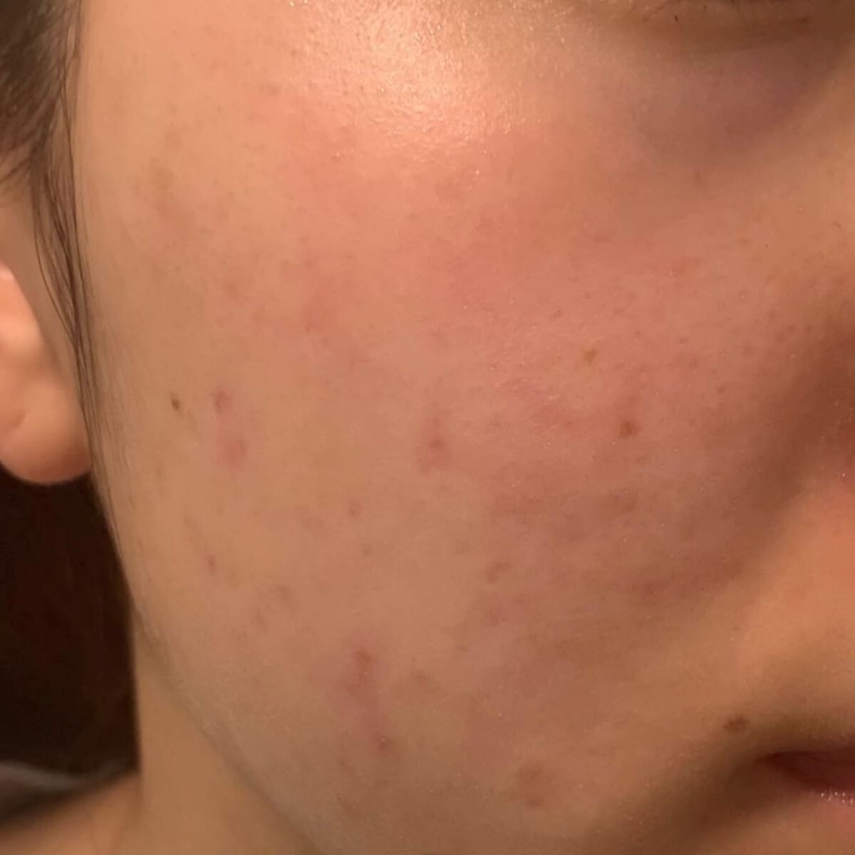 skinmarche WAOPLUS ハートリーフマグワートブースターマスク/ブレーンコスモス/洗い流すパック・マスクを使ったクチコミ（2枚目）