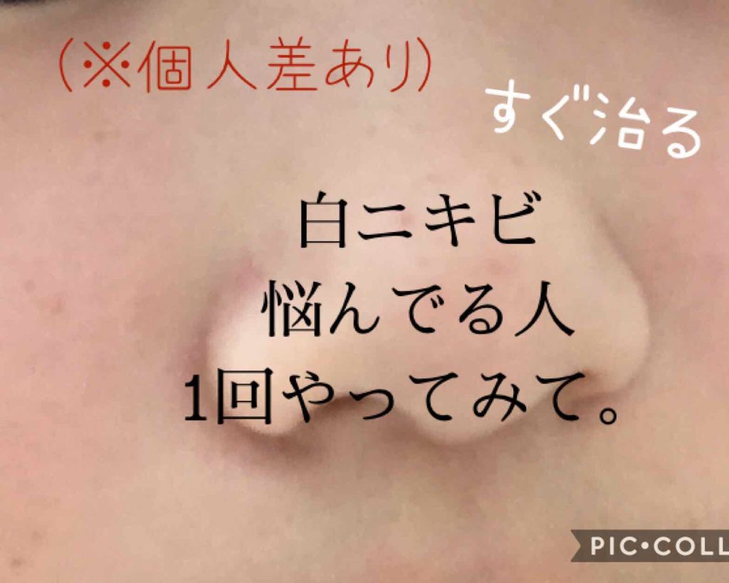 菊正宗 日本酒の化粧水 高保湿/菊正宗/化粧水を使ったクチコミ(1枚目)