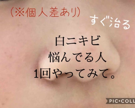 菊正宗 日本酒の化粧水 高保湿/菊正宗/化粧水を使ったクチコミ(1枚目)