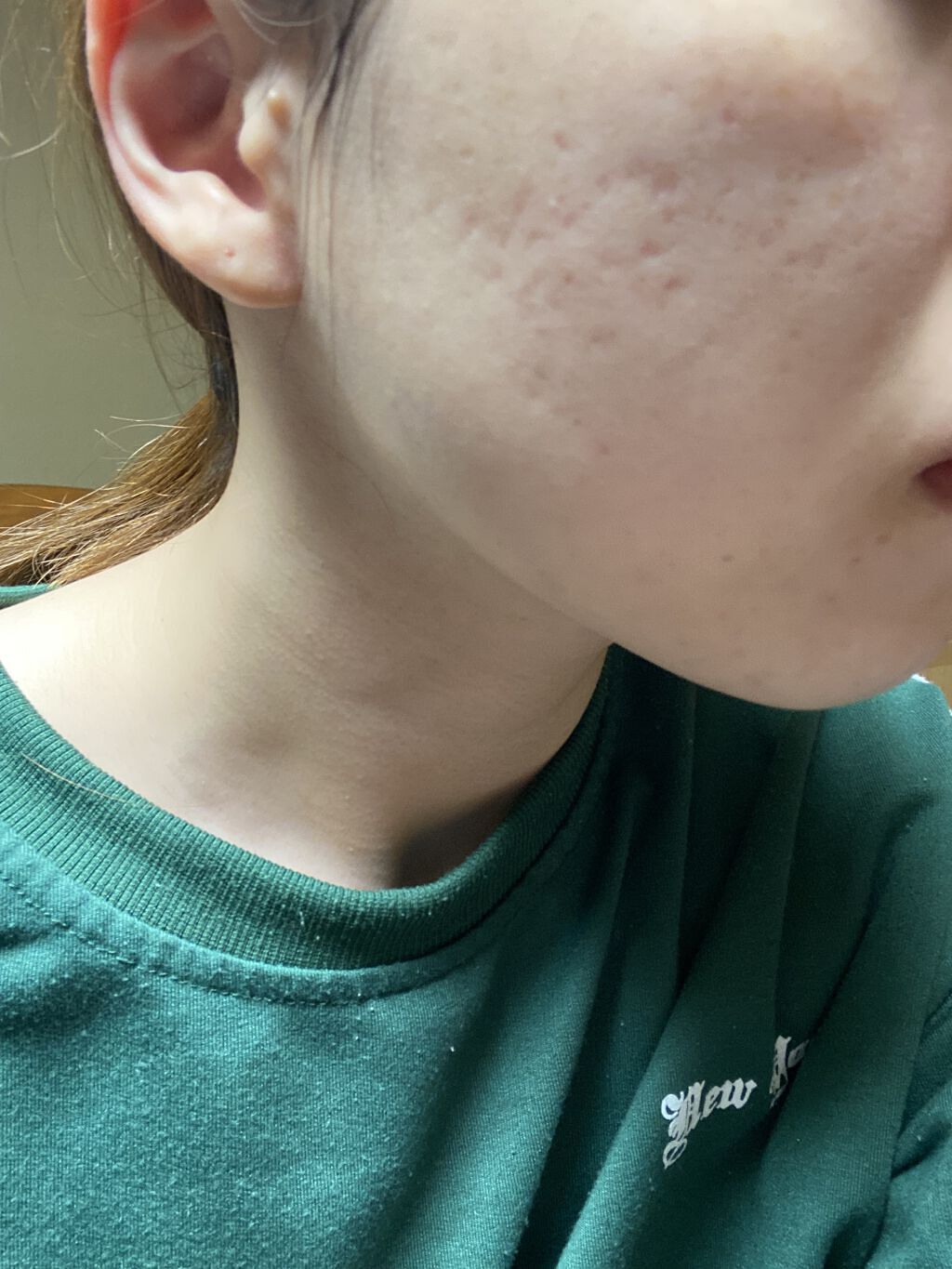 モイスチャー リッチローション(とてもしっとり)/アルージェ/化粧水を使ったクチコミ（2枚目）